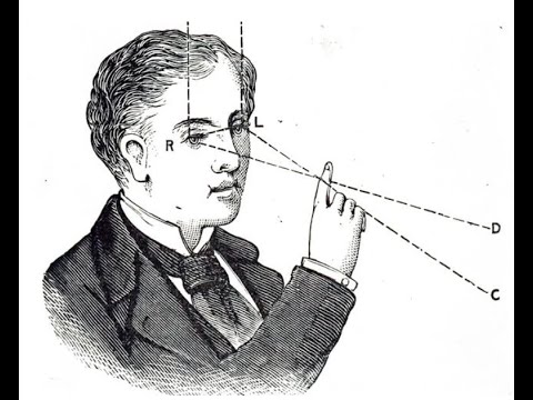 Como funciona a estereotaxia da mamografia?