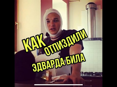 Как эдварда била избили!!!!!