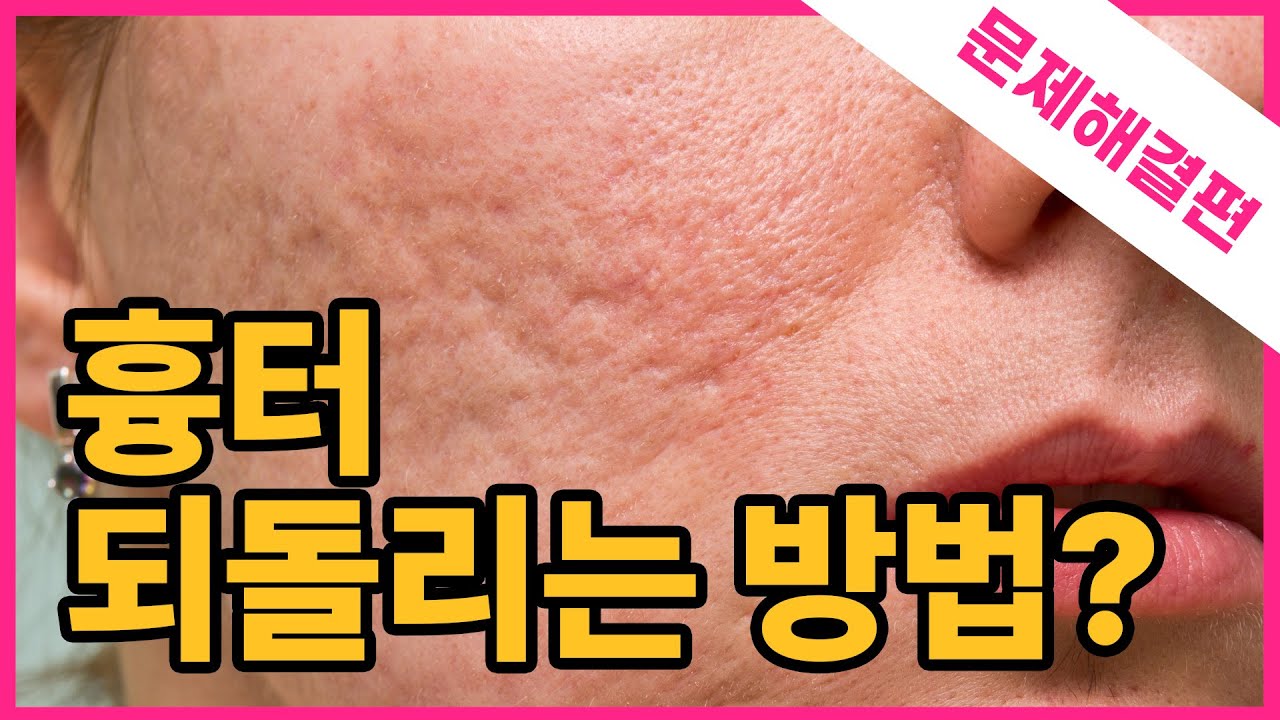 related_video_thumbnail