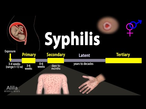 Syphilis - Pathophysiology, Diagnosis and Treatments, Animation