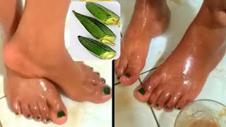Remove dry wrinkled feet & legs get rid of old legs using okro fast