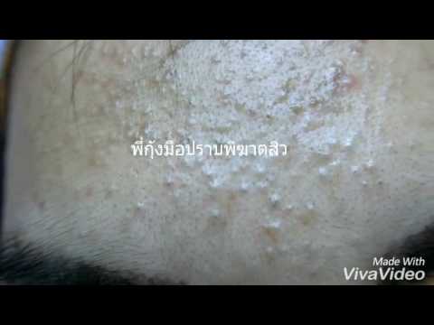 เพิ่มสมาชิกกล วิธีการที่จะมีความมั่นใจในความแข็งแรง