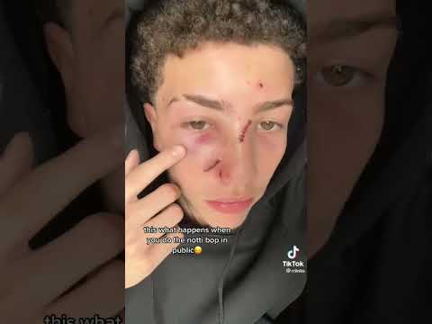 this what happens when you do the notti bop dance in public ⚠️😳🤯 #nottigang #shorts #ddosama #e4n