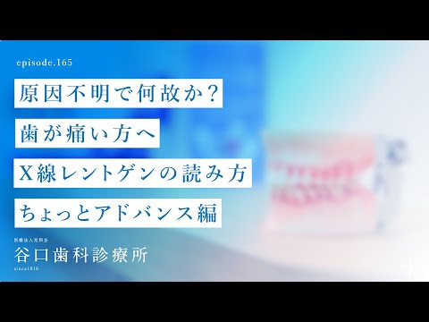 第165話 原因不明で何故か❓歯が痛い方へ -X線 ‍♂️レントゲンの読み方-ちょっとアドバンス編-札幌駅前-赤れんがテラス6階-谷口歯科診療所