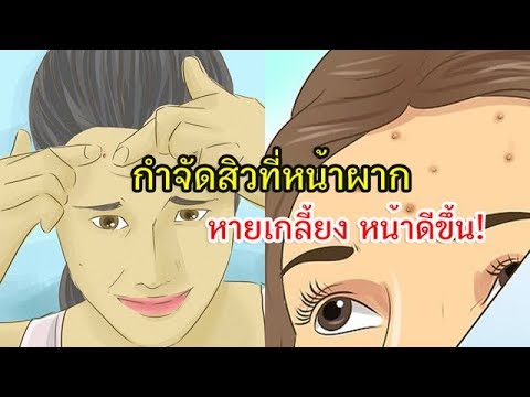 ครีมของไข่แดงในโรคสะเก็ดเงิน ครีมฮอร์โมนสำหรับกลาก
