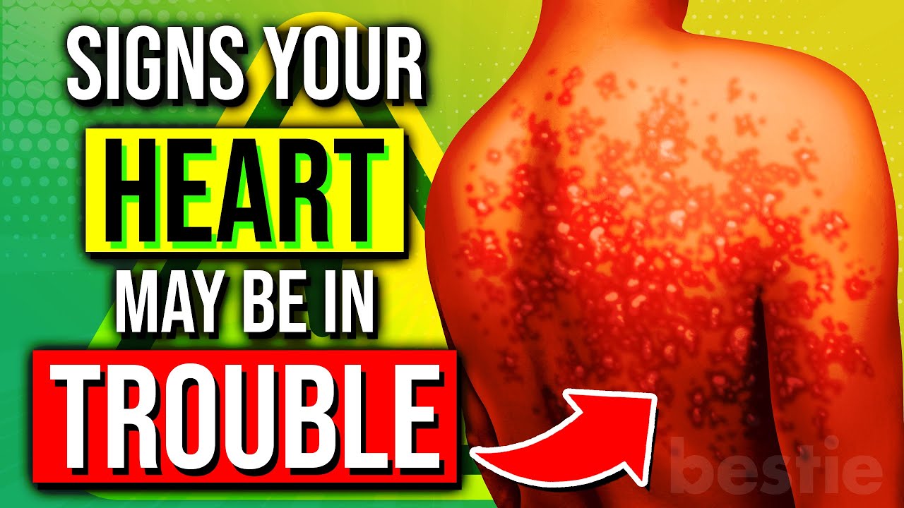 Don't Ignore The 4 WARNING Signs Your HEART May Be In TROUBLE!