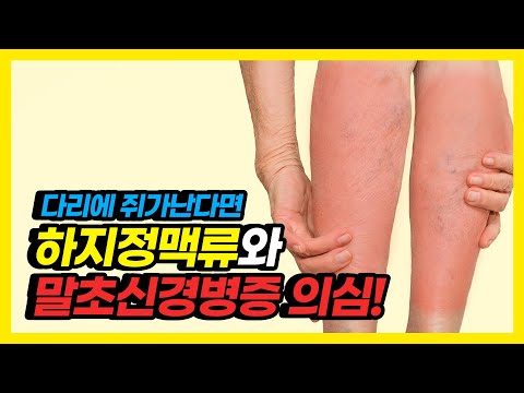 다리에 쥐가 계속 난다면, 특히 주의해야 할 질환들!