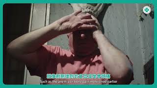 多發性骨髓瘤的診斷與治療│李柏憲醫師