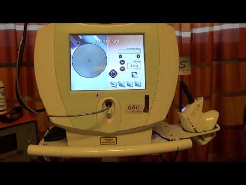 Docteur pour varice Docteur pour varice