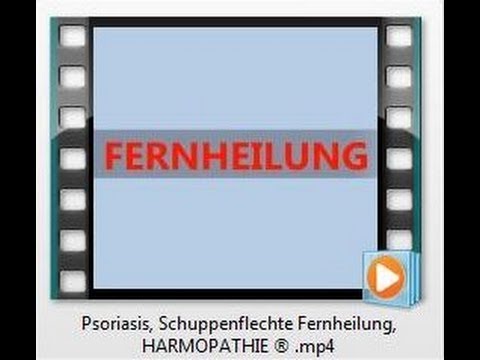 Die gen-ingenieurmässigen Präparate für die Behandlung der Schuppenflechte Der paradiesische Garten die chinesischen Präparate von der Schuppenflechte