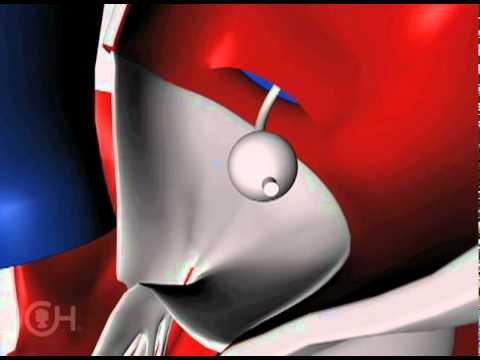 Balloon Atrial Septostomy to Treat Transposition of the Great Arteries (TGA) - CHOP