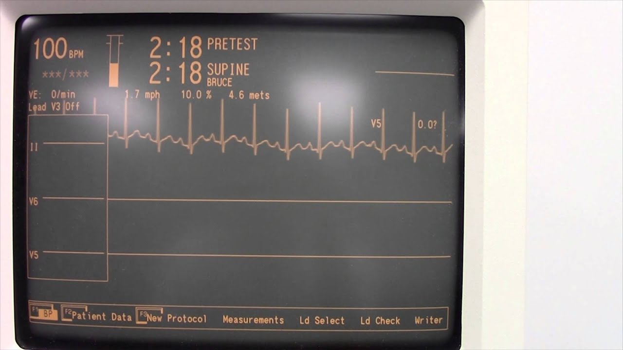 Maximal Graded Exercise Test at the SPAHCC