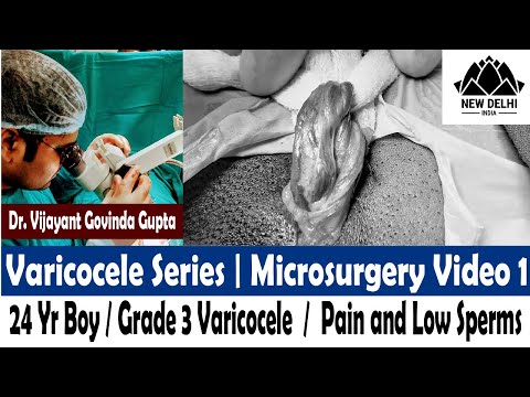 varicocele - Potenciazavar Varicocele gyenge erekció