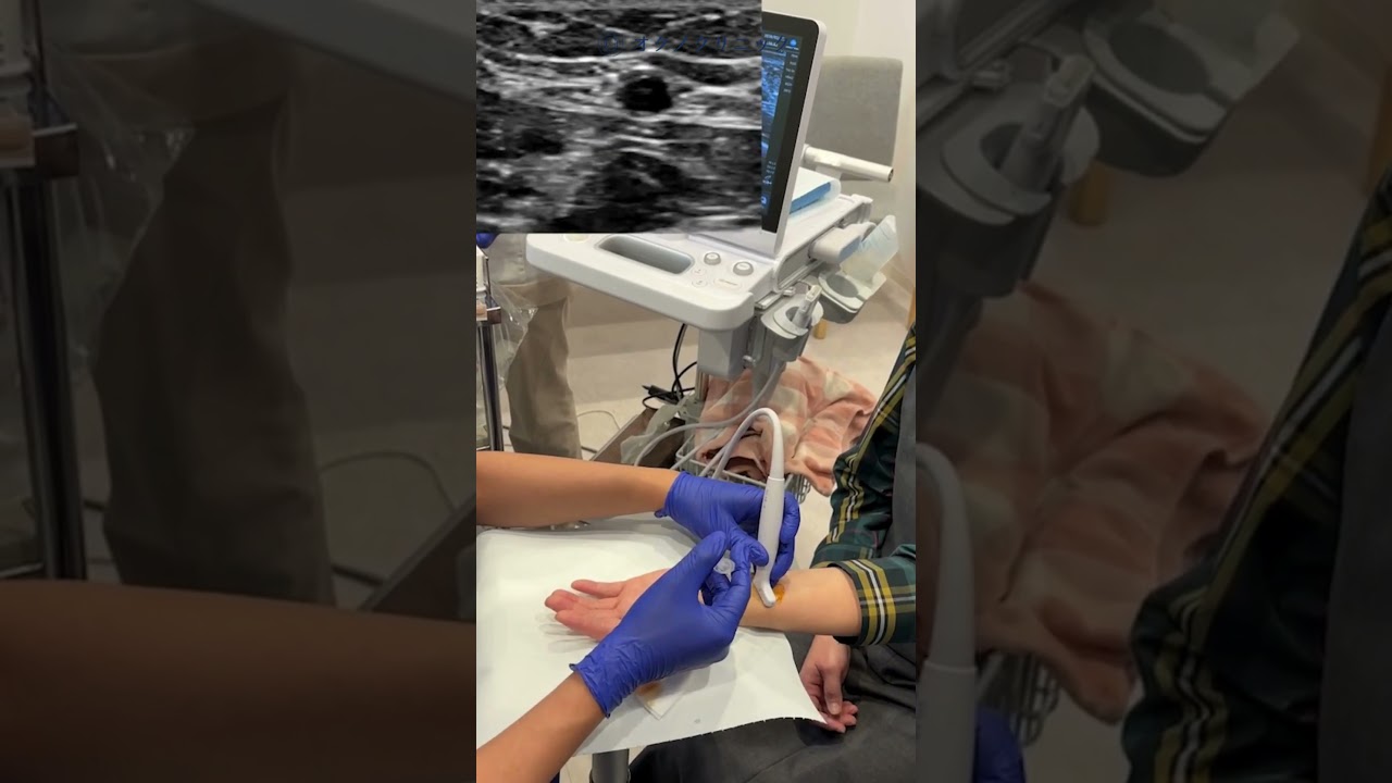 指の第一関節が痛い…へバーデン結節に「動注治療」という選択肢