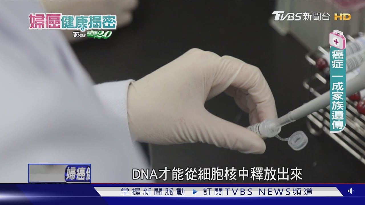 卵巢癌75%病患確診已晚期 「這些族群做這件事」找致癌基因