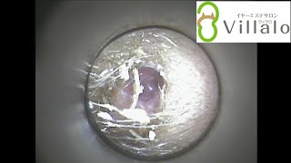 耳掃除動画vol.46「自分で耳掃除しなくなりました」