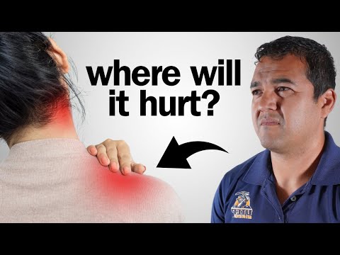 Rotator Cuff Tear: 3 Key Pain Spots