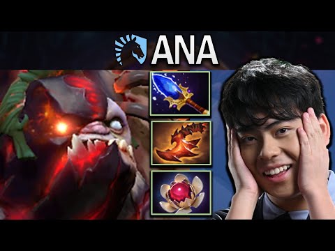 Pudge Dota 2 Gameplay RNG.Ana with 20 Kills and Overwhelming Blink #dota #dota2