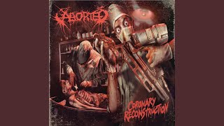 Download lagu Coronary Reconstruction mp3 Download lagu Coronary Reconstruction mp3