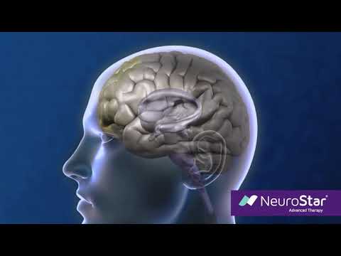 How NeuroStar Works |  Pacific Phoenix Psychiatry