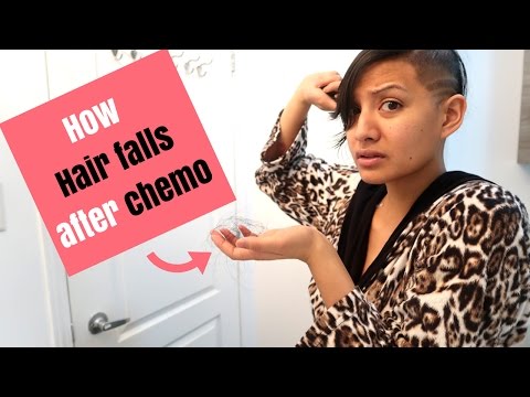 HOW and WHEN hair falls out post chemo