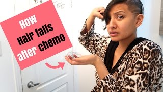 HOW and WHEN hair falls out post chemo