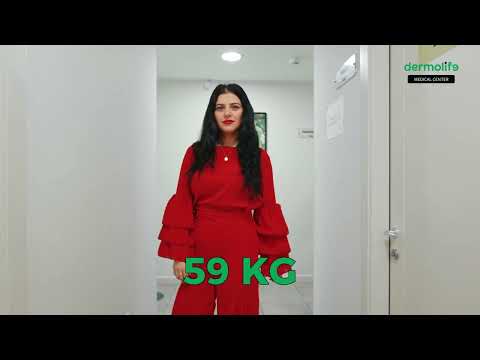 Zvogelimi i Stomakut, Shoqja Edone -40 kg