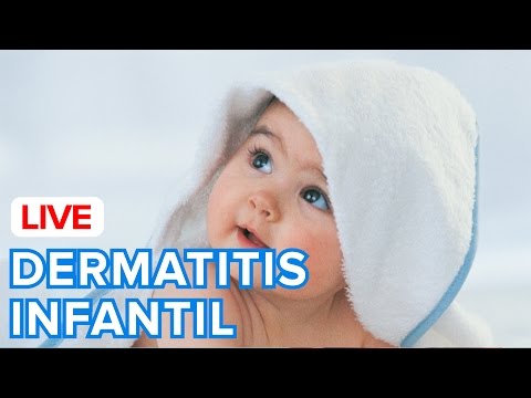 Si es posible la leche a la psoriasis Los tratamientos de la psoriasis sobre los codos