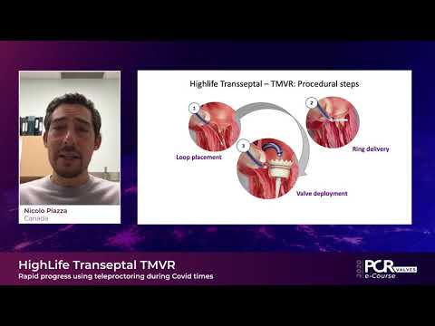 Transeptal TMVR – Rapid progress using teleproctoring during Covid times - PCR Valves e-Course 2020