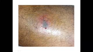 Animales Ponzoñosos