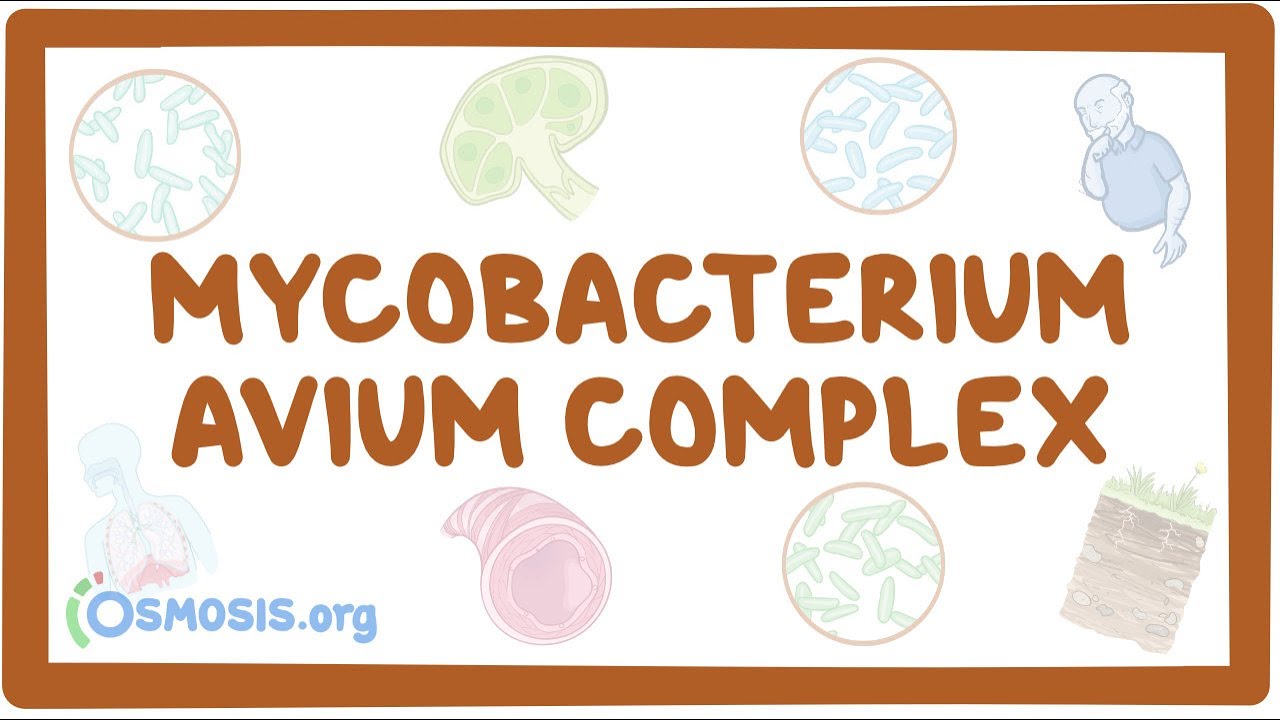 Mycobacterium avium complex - causes, symptoms, diagnosis, treatment, pathology