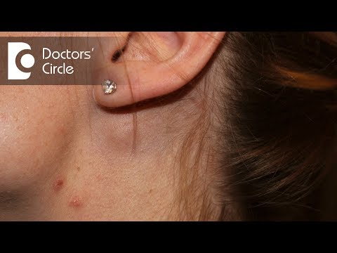 Post Auricular Lymph Node