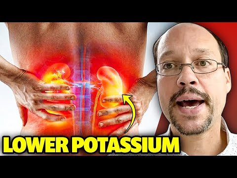 High Potassium Kidney Disease How To Lower It Naturally