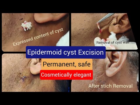 Grace Clinic video