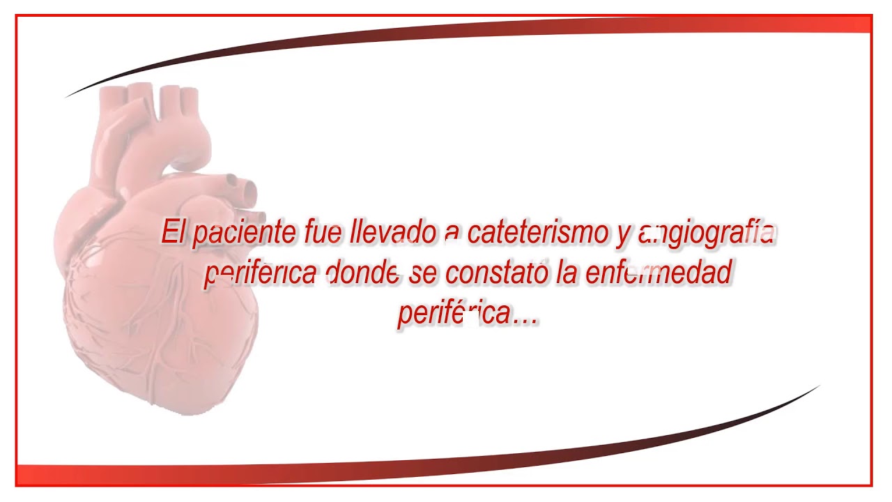 Carlos Alberto Aguirre Molina-17