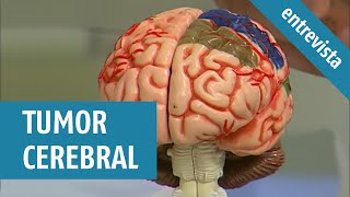 Tumor Cerebral | Causas, sintomas e tratamentos (Entrevista Claudete Troiano)