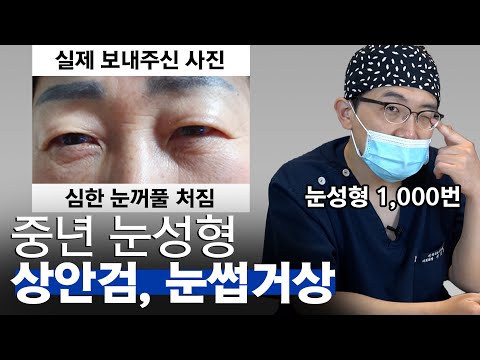中年眼部 03