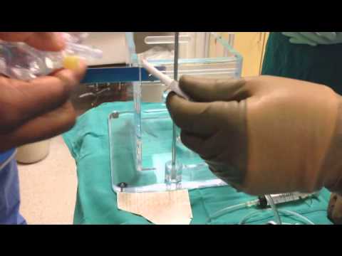 Radiomicrosphere Therapy