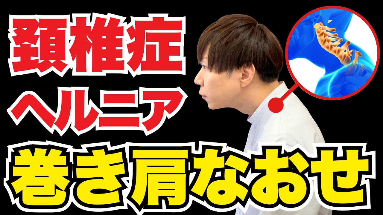 【50代・60代必見】頚椎症の9割は“巻き肩”が原因