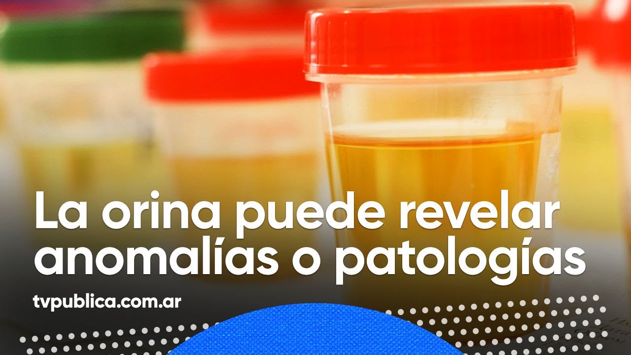 Los 8 tipos de orina que nos revelan información de nuestra salud - Mañanas Públicas
