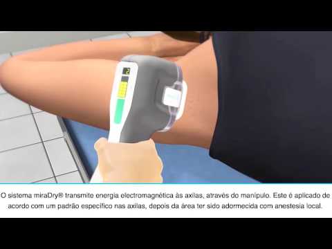 Tratamento do Suor Excessivo com MiraDry® | Hiperidrose Axilar Tratamento