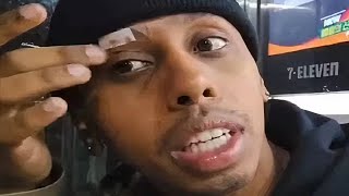 Johnny Somali é uma VITIMA AGORA