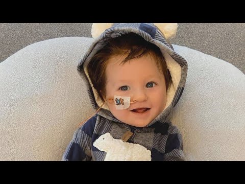 Baby Boy With Pierre Robin Sequence Treated By Special Team At Children's Hospital Colorado