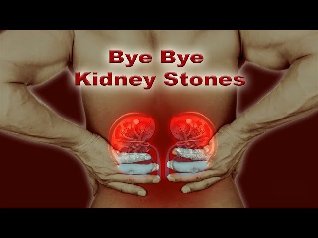 Video pronuncia di renal lithiasis in Inglese