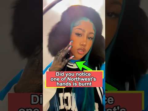 Did you notice one of Northwest's hands is burnt? That’s why she always looks older than Blue Ivy.