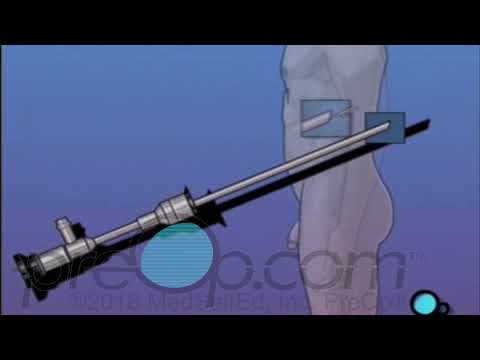 Cystoscopy Procedure Male  - PreOp® Patient Education and Engagement