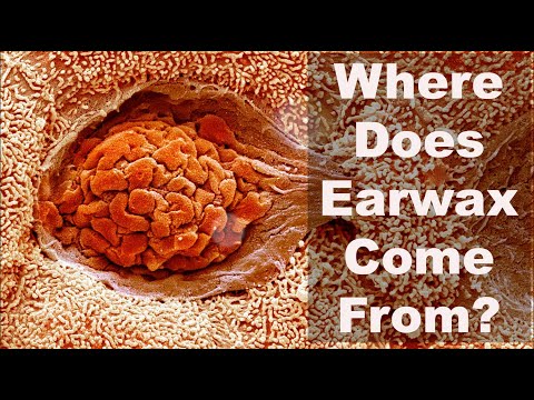 Where Does Earwax Come From?