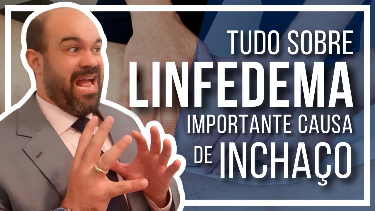 🔴 Tudo sobre o LINFEDEMA [Importante e temida causa de Inchaço]