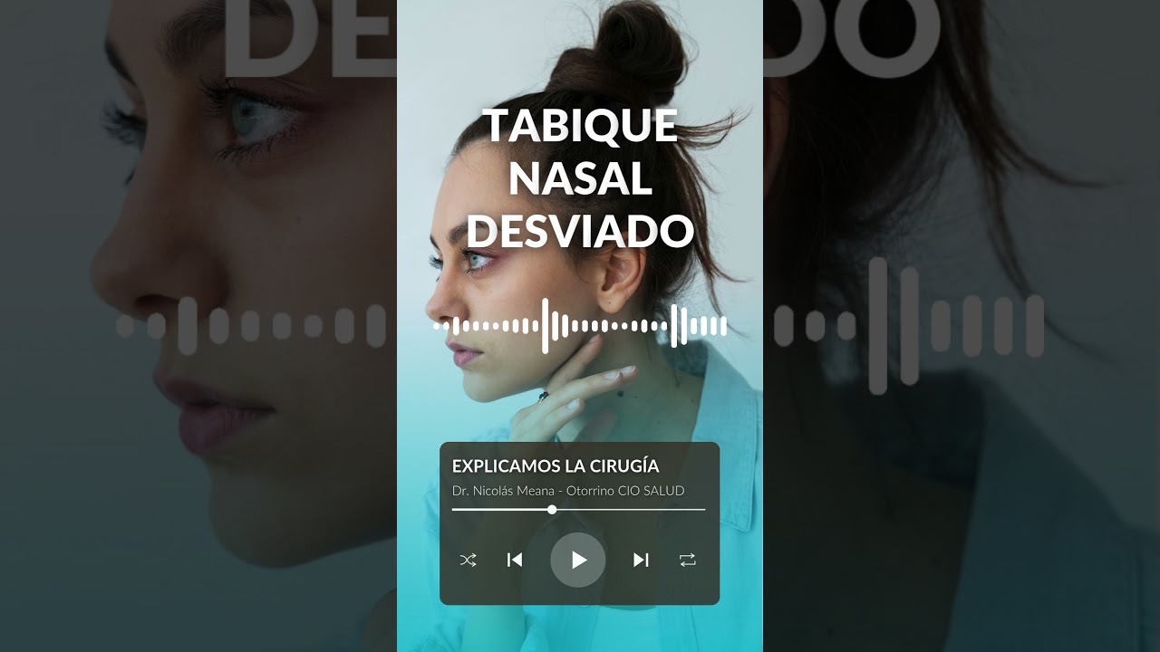 Nicolás Meana Cadrecha-11