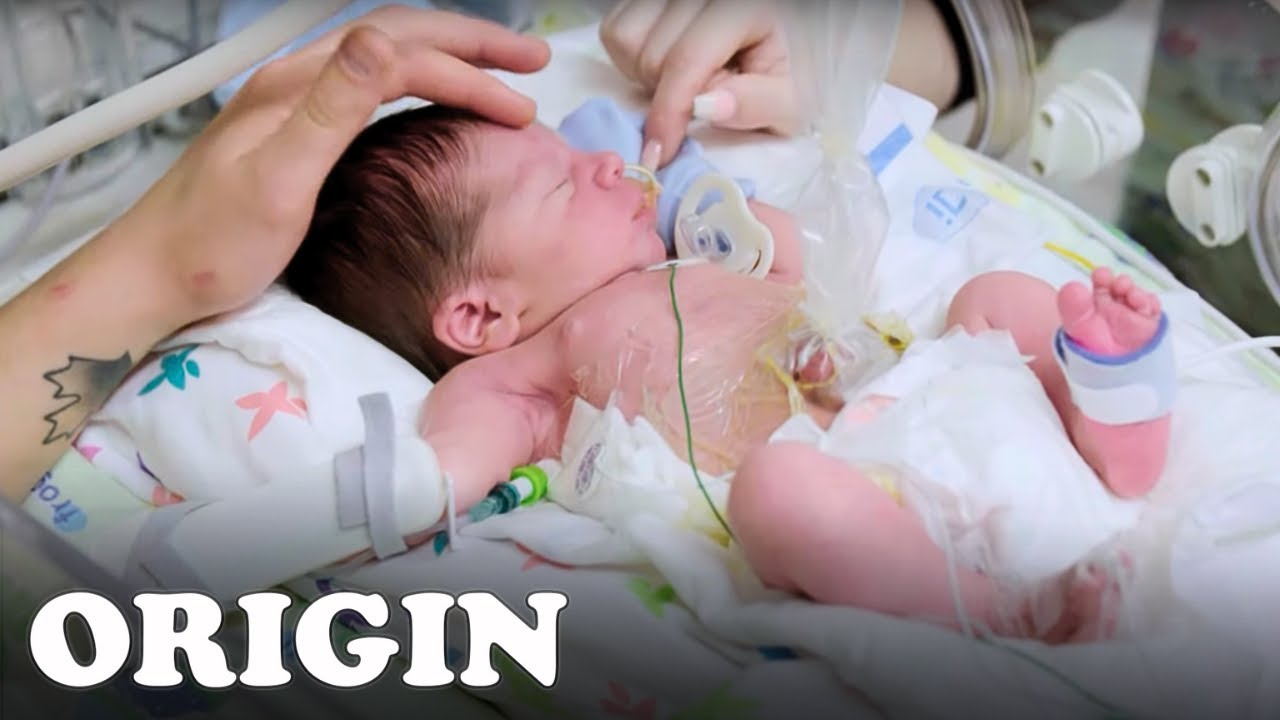 This 2 Day Old Baby Is Beginning It's Life In Intensive Care | Children's Hospital | Full Episode
